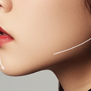 Thẩm mỹ cằm và hàm 