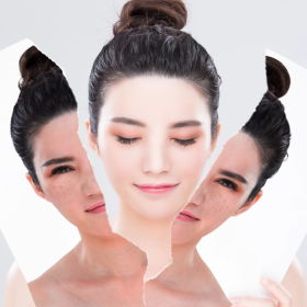 Truyền trắng da là gì? 